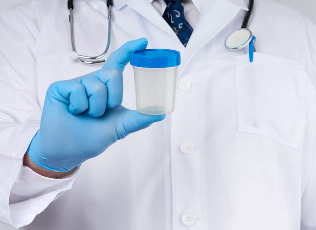 Mannelijke arts in een witte jas en stropdas staat en houdt een plastic container vast voor een urinemonster | waarom urine inleveren bij rijbewijskeuring | Rijbewijsdokter